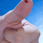 Sind Diabetiker anfälliger für Infektionen?